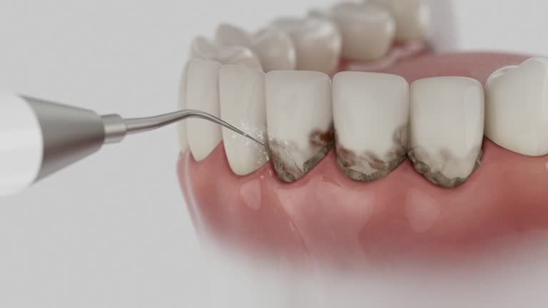 Reliable Dental Implants contractor in Moscow, ID by Smile Center Dentistry